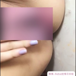 商品女性私密护理工就娆紫薇扩阴器，舒缓某处不适，改善神秘地带口问题，提升性生活质量