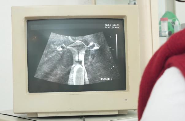 医院B超神秘地带：奇葩剧情，妆容惊艳，热度爆表！